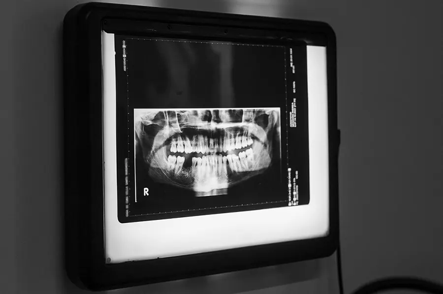 controllo radiografia