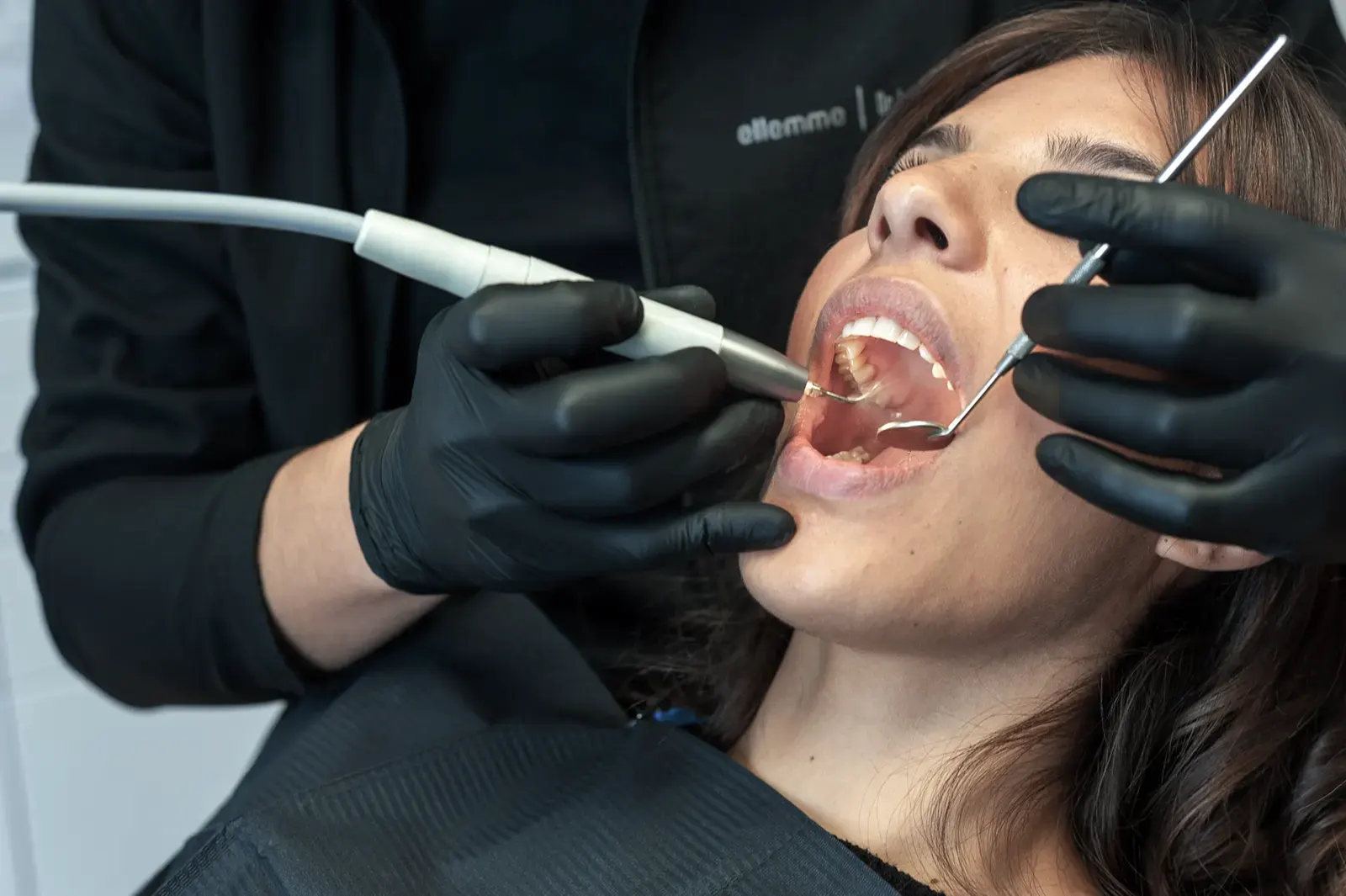 Pulizia dei denti presso, Studio Pieretti Montefiascone (Viterbo)